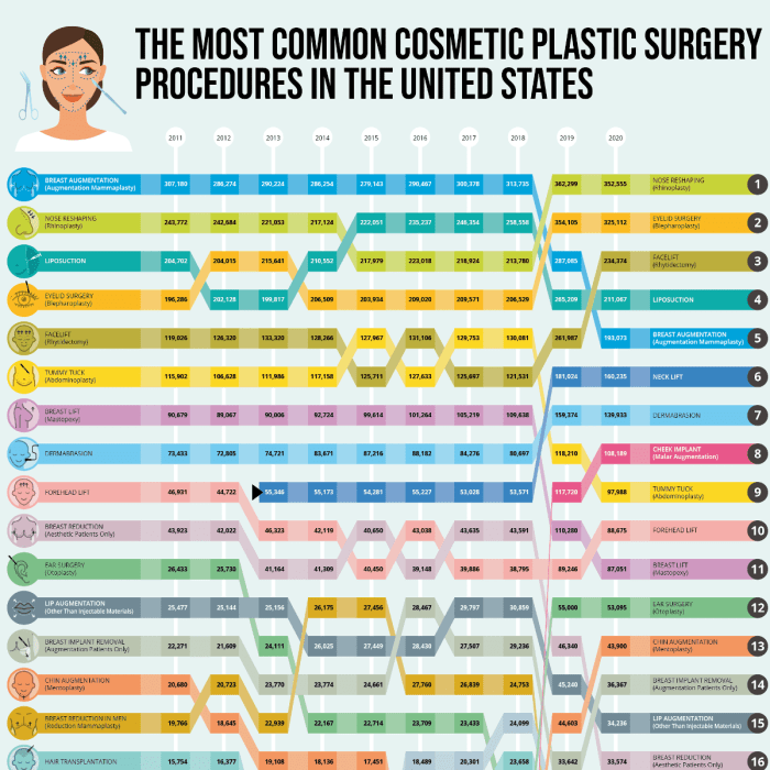 Apakah Operasi Plastik Akan Semakin Umum Di Tahun 2025?