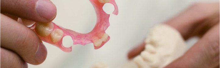 Valplast flexible denture dentures swansea romak Contoh Gigi Palsu Valplast